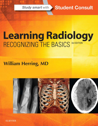 Learning Radiology: Recognizing The Basics / William Herring YKS Fotokopi